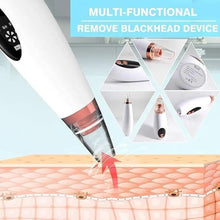 Load image into Gallery viewer, Electric Rechargable Blackhead Remover