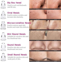 Load image into Gallery viewer, Electric Rechargable Blackhead Remover
