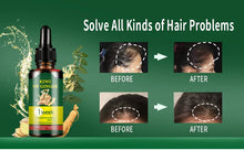 Load image into Gallery viewer, Hair Growth Oil
