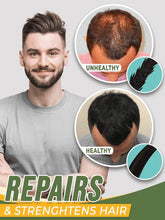 Load image into Gallery viewer, Hair Growth Oil