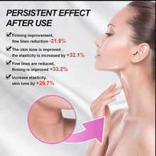 Load image into Gallery viewer, Dark Circle Eye Cream