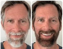 Load image into Gallery viewer, Anti-Greying Hair Serum