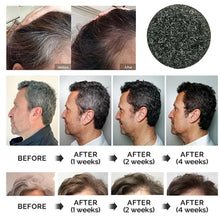 Load image into Gallery viewer, Anti-Greying Hair Serum