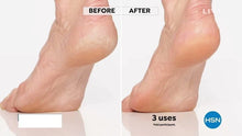 Load image into Gallery viewer, Pedi Electronic Tool File and Callus Remover Pedicure | Cordless Rechargeable Polishing Wand with 2 Roller Heads