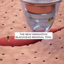 Load image into Gallery viewer, Electric Rechargable Blackhead Remover