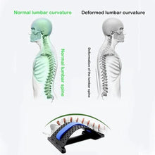 Load image into Gallery viewer, Back Pain Relief Product Back Stretcher, Spinal Curve Back Relaxation Device, Multi-Level Lumbar Region Back Support for Lower and Upper Muscle Pain Relief
