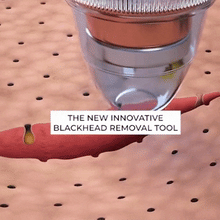 Load image into Gallery viewer, Electric Rechargable Blackhead Remover
